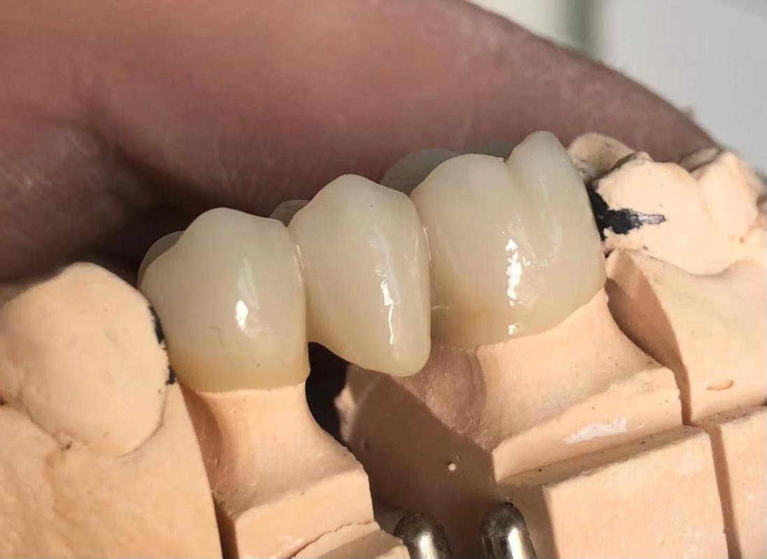 Dental Materials 3D Pro Multilayer Zirconia Block CAD CAM 98mm System Ceramic Block for Long Bridge