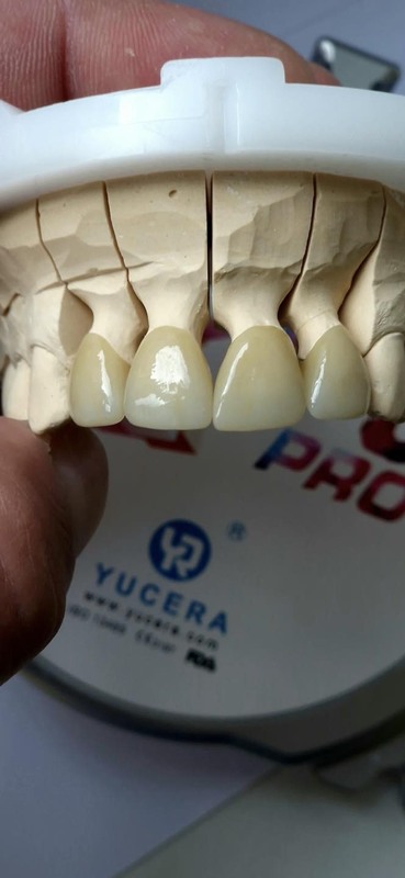 Dental Whole Sale Yucera 4d Pro Multilayer Zirconium Disc Ceramic  for Cad Cam High Transmittance