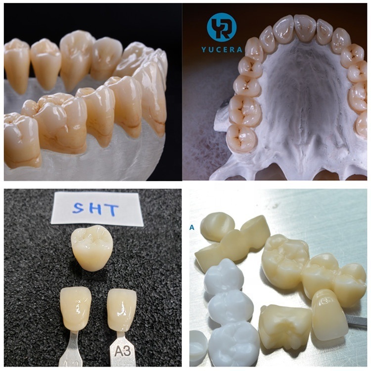 Yucera Denture Teeth Multilayer SHT  Pre Shaded Zirconia  Block 95mm for Dental Cad Cam