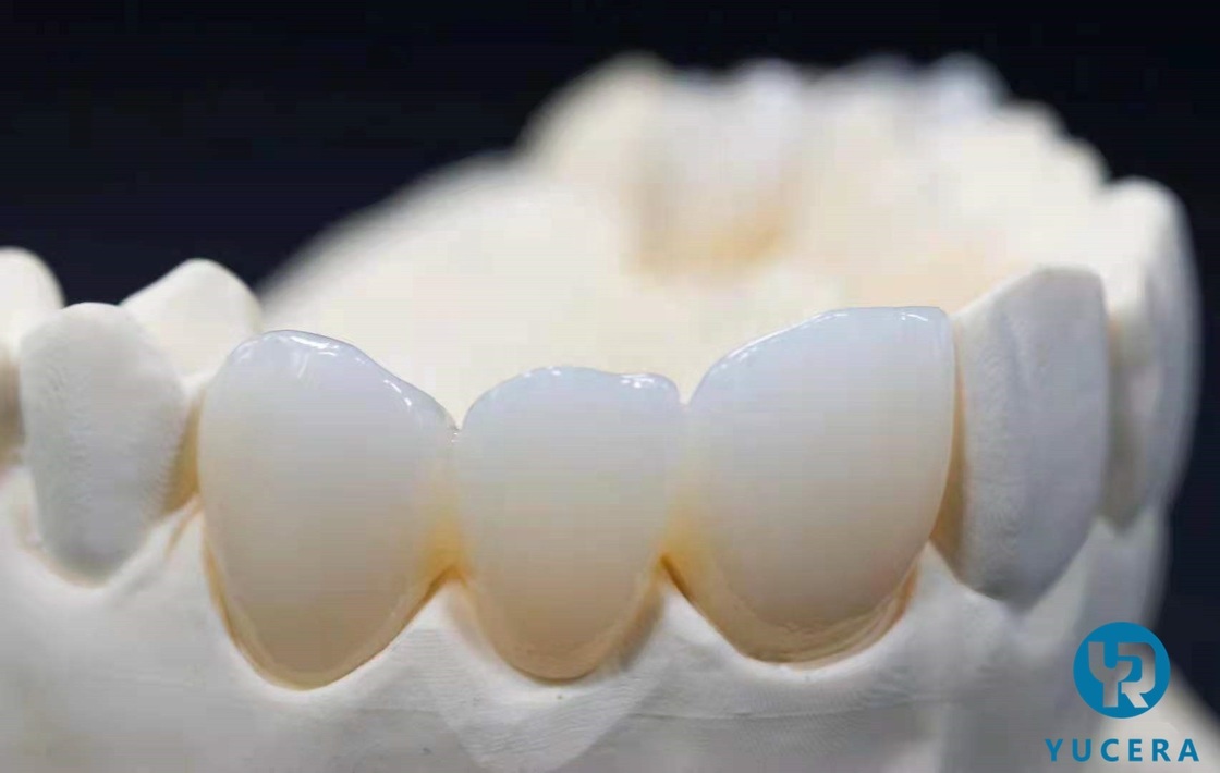 Yucera Denture Teeth Multilayer SHT  Pre Shaded Zirconia  Block 95mm for Dental Cad Cam