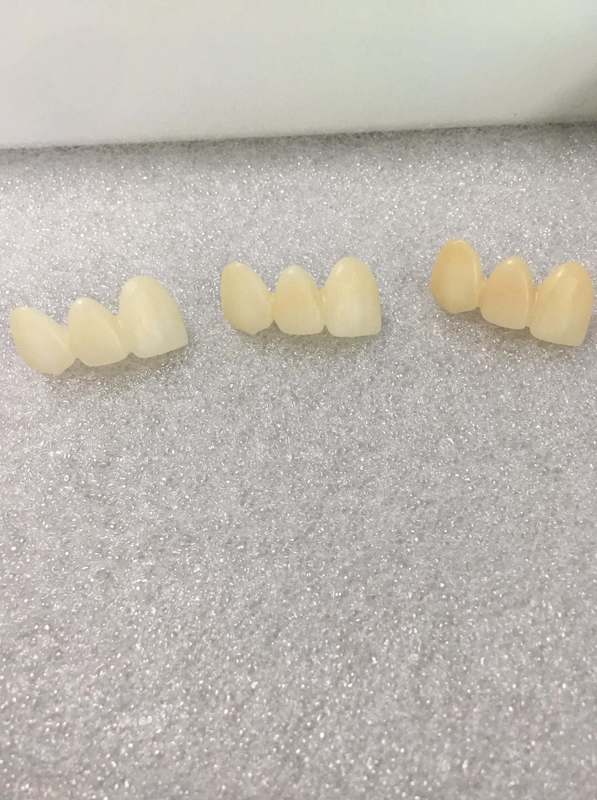 3D Plus Multilayer 43% -57% 6 Layers 3D Zirconia Dental Block Disc CAD CAM 95mm System for Dental Lab with ISO CE Certificate