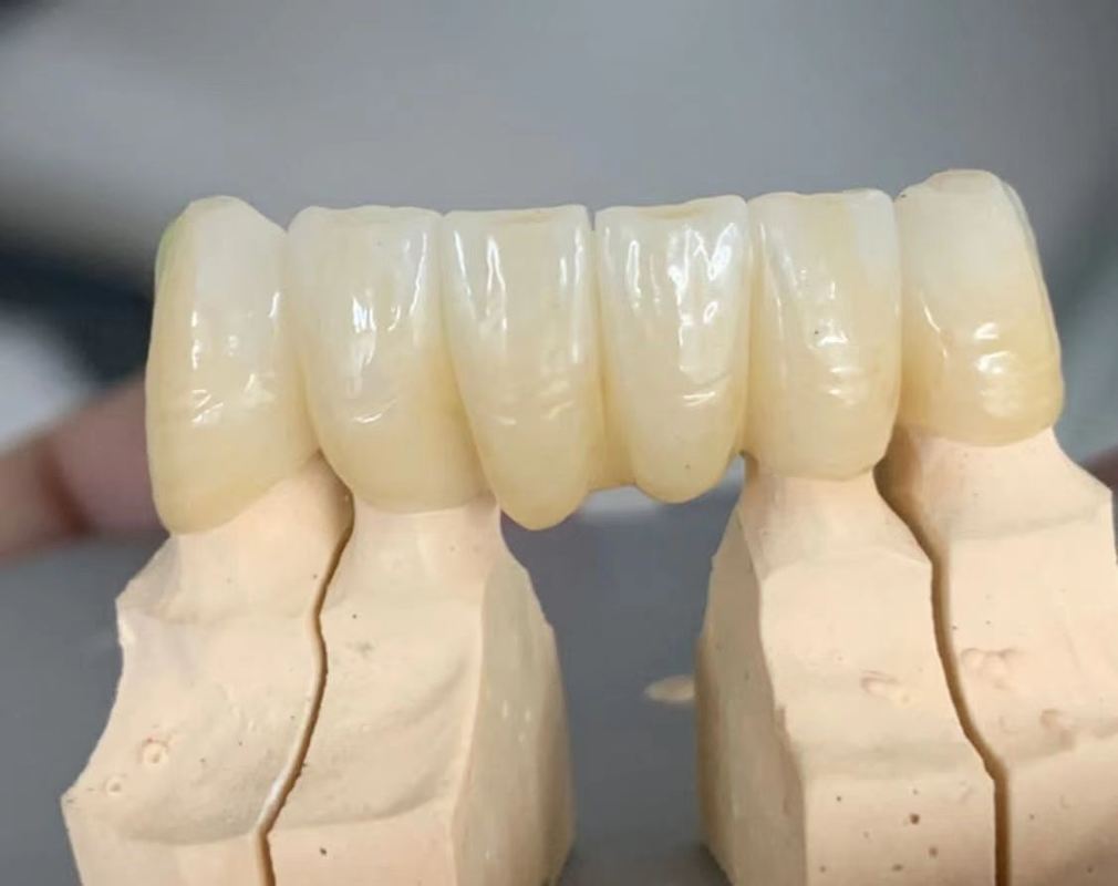 Yucera  3D Pro Multilayer Multilayer Zirconia Block Cad /cam System  Ceramic Block 95mm System  for  Dental Lab