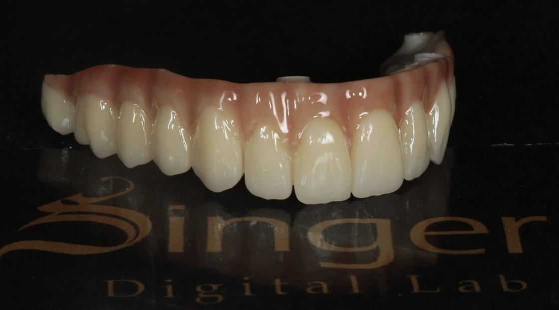 For Yucera 4D Pro Zirconia Dental Block Disc Crown Bridge CADCAM Disc for Dental Lab Made From Wood Resin Machinery Power Source
