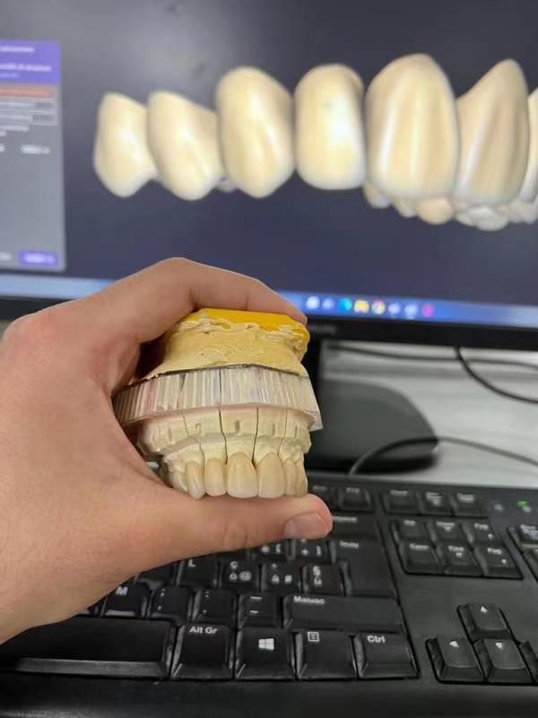 For Yucera 4D Pro Zirconia Dental Block Disc Crown Bridge CADCAM Disc for Dental Lab Made From Wood Resin Machinery Power Source
