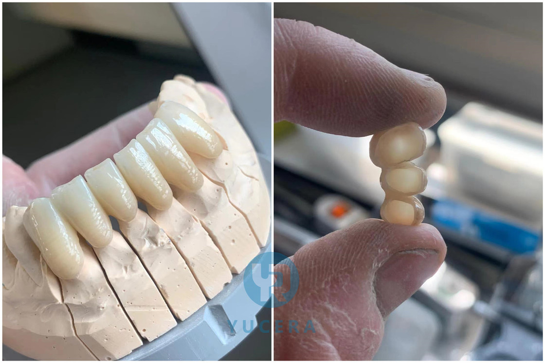 YUCERA 1200MPa 98 HT Dental Zirconia Blocks Dental Consumable Pre Shaded Zirconia Dental Zirconia  Block