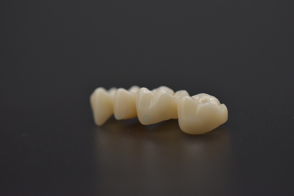 Cad Cam Ceramic Blocks Zirconia Dental Laboratory for Porcelain False Teeth Preshaded Zirconia Block in ST Color