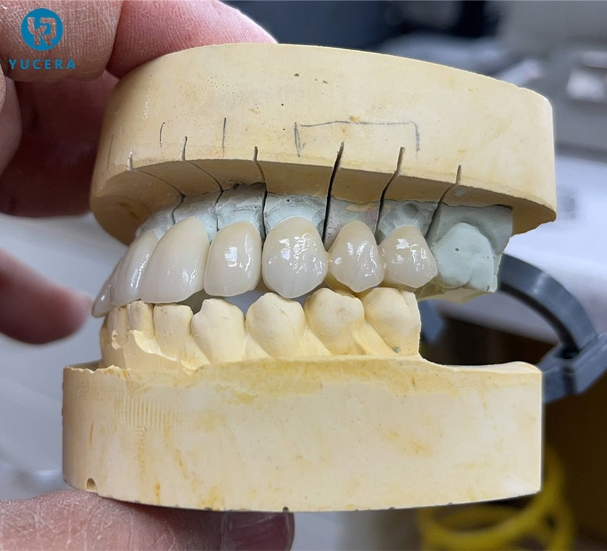 Hot Sale 4D Dental Ceramic Pre-Shaded Multilayer  Zirconia Block Cad Cam Dental Lab for Half Mouth