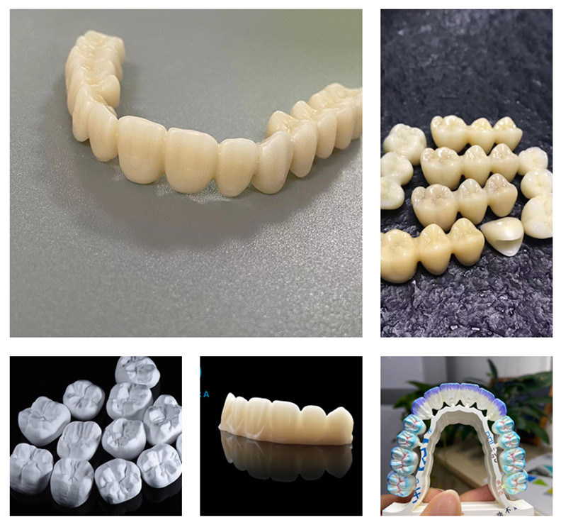Yucera Price for Promotion Dentist Denture Zirconia Disc Zirconia HT White Dental Zircon Blocks