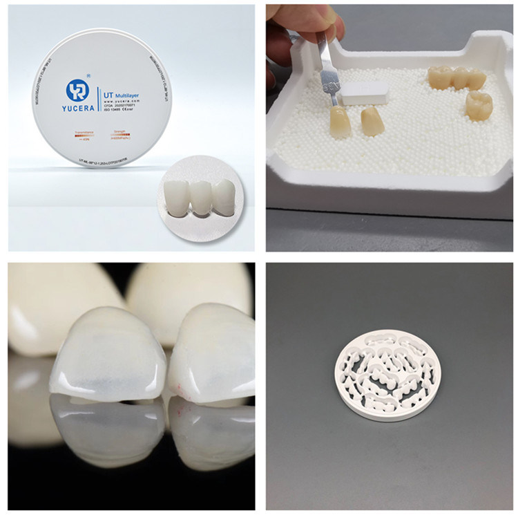 Yucera UT White Multilayer Construction Durable Ceramic Blocks the Dentist's Choice for Strength and Aesthetics