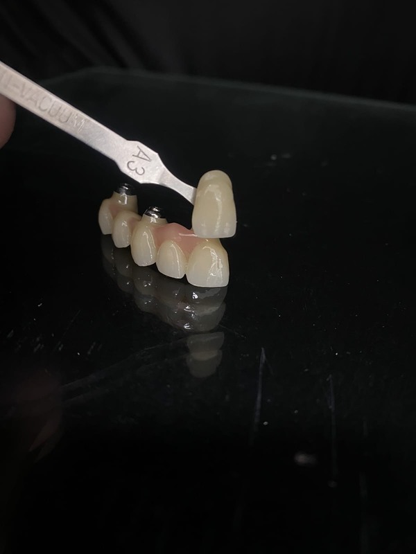 Yucera 98mm Open Precolored ST Color 16 Color Dental Zirconia Block for Dental CAD CAM Milling  Zirconia Blanks 43% Translucency