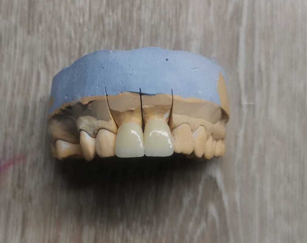 Yucera ST Color Preshaded Zirconia Blocks  Zirconium Material Cadcam Milling Ceramic Disc Super Translucent Dental Zirconia Cera
