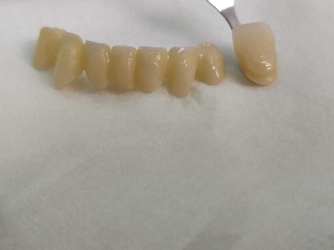 Yucera ST Color Preshaded Zirconia Blocks  Zirconium Material Cadcam Milling Ceramic Disc Super Translucent Dental Zirconia Cera