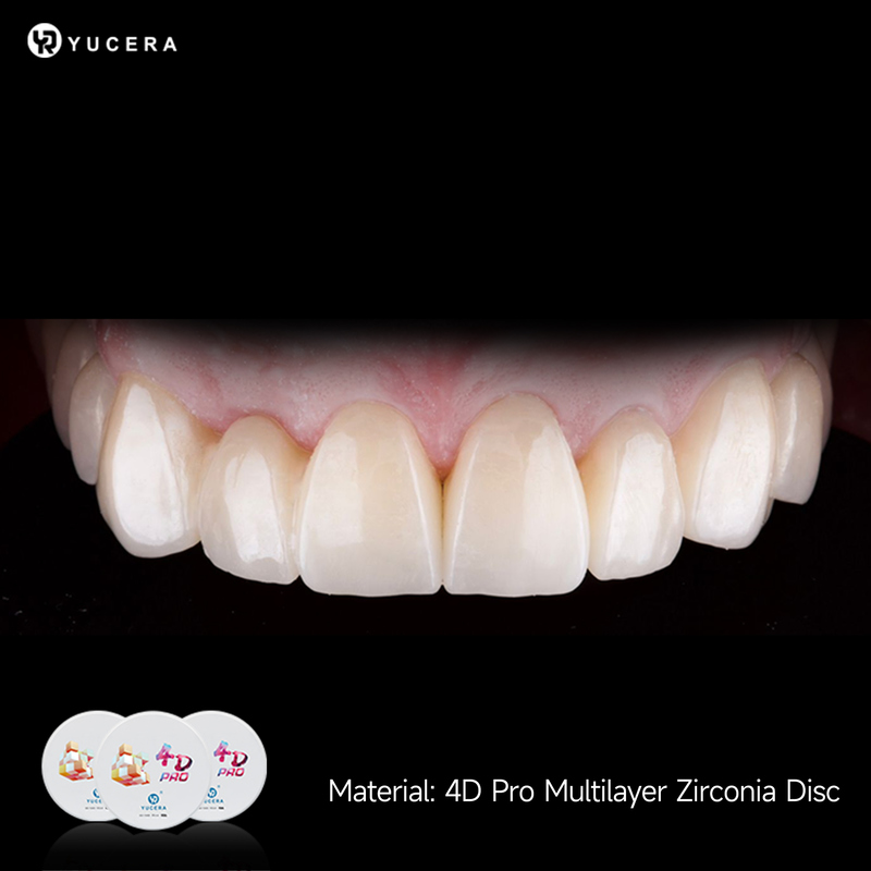 43%-57% Translucency 700-1200 MPa Bending Strength YUCERA Dental 98mm Open System CAD/CAM 4D Pro Multilayer Zirconia Block