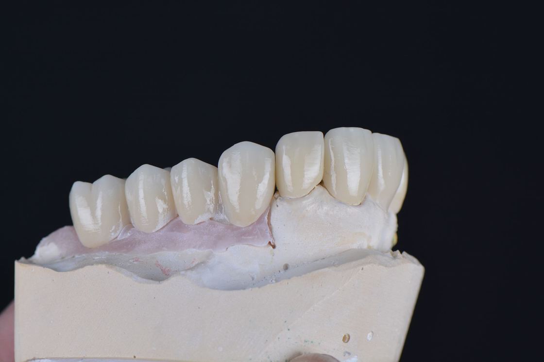 43%-57% Translucency 700-1200 MPa Bending Strength YUCERA Dental 98mm Open System CAD/CAM 4D Pro Multilayer Zirconia Block