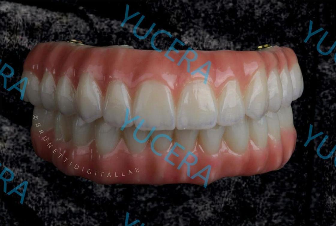 Yucera 4D Plus Multilayer Zirconia Block Explore with CE ISO Dental Zirconia Multilayer Open System
