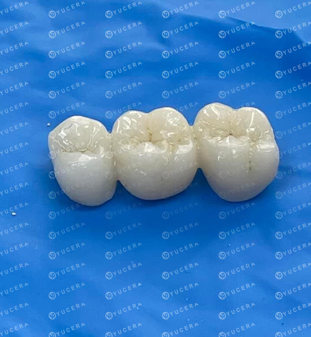 Yucera Cam Machine for Dental Laboratory Dental Sintering Furnace for Zirconia Material