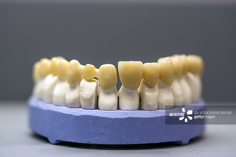 Yucera STwhite 3D Multilayer Zirconia Blocks A Game - Changer for CAD/CAM Dental Work