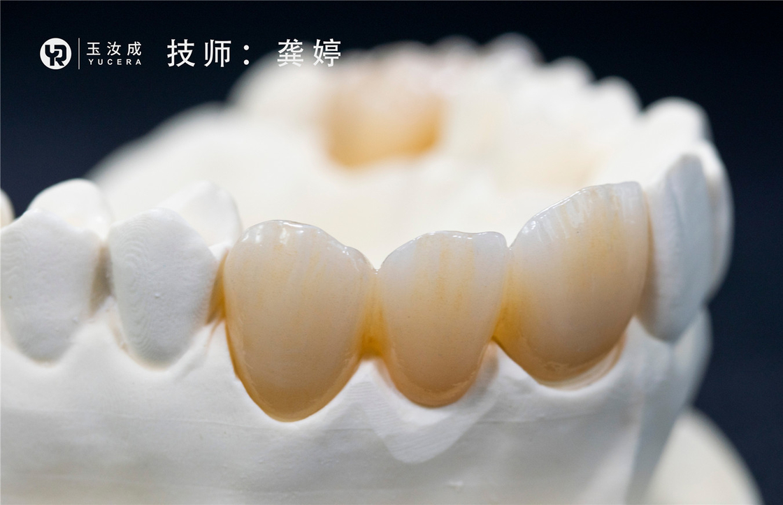 Arka Taç için Yucera 3D Plus Çok Katmanlı Zirkonya Blok 98x16mm Açık Sistem